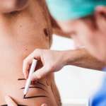 Doctor adding marks on man's 