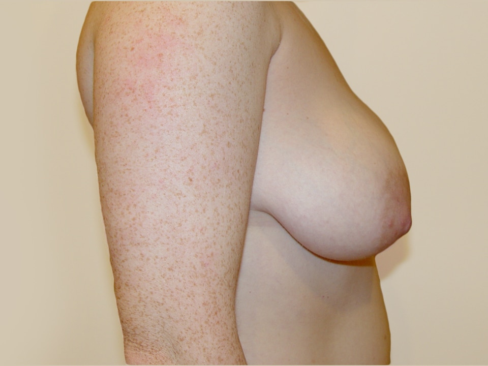 Before & After Patient