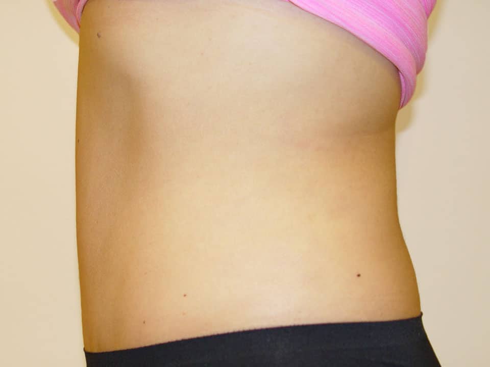 Before & After Patient