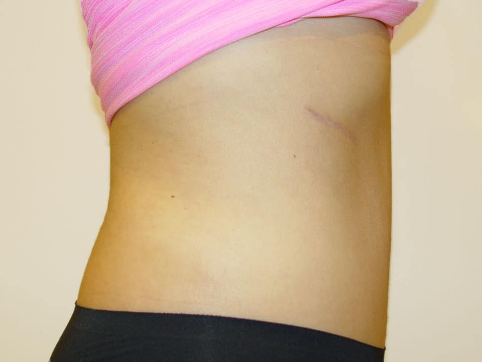 Before & After Patient