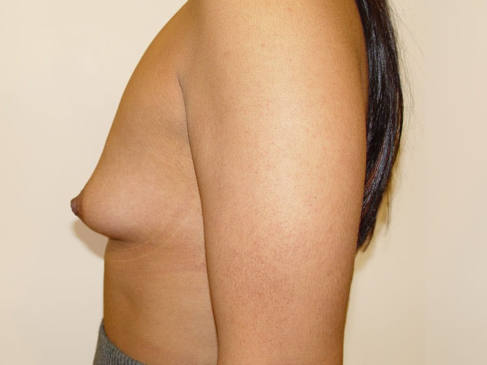 Before & After Patient