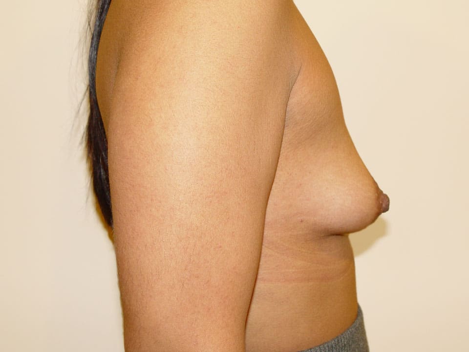 Before & After Patient